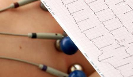  imagem Eletrocardiograma